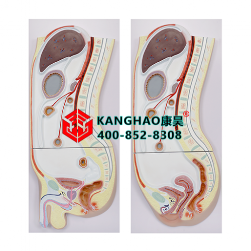 腹膜矢状切面模型